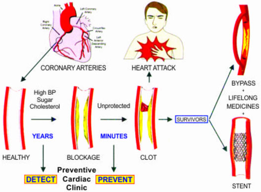 Preventive Cardiology - Safe Health Heart Centre