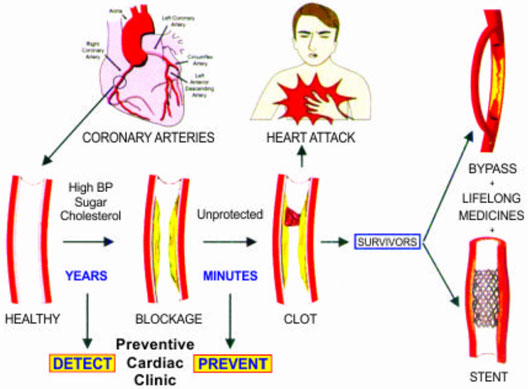 Heart Flow Chart